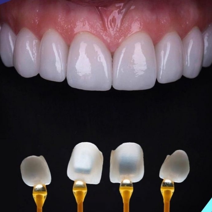 NHA KHOA CÔNG NGHỆ CAO | NHA KHOA BÀ RỊA VŨNG TÀU | HỆ THỐNG NHA KHOA BÀ RỊA VŨNG TÀU